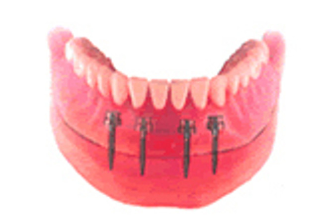 �C���v�����g�𒷎��������邽�߂ɑ�؂ȃ����e�i���X