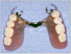 �]���̎��Á@�u���b�W�E�`��