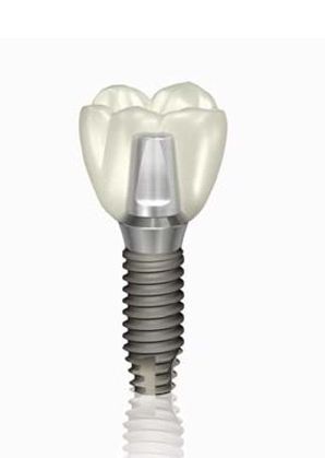 �C���v�����g������