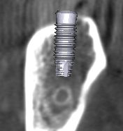 ���ȗp�b�s��2