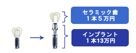 �C���v�����g���Ô�19.8���~