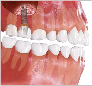 �\�P�b�g���t�g